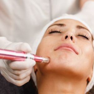 Dermapen Madrid tratamiento médico estético de la Clínica de Medicina Estetica DA