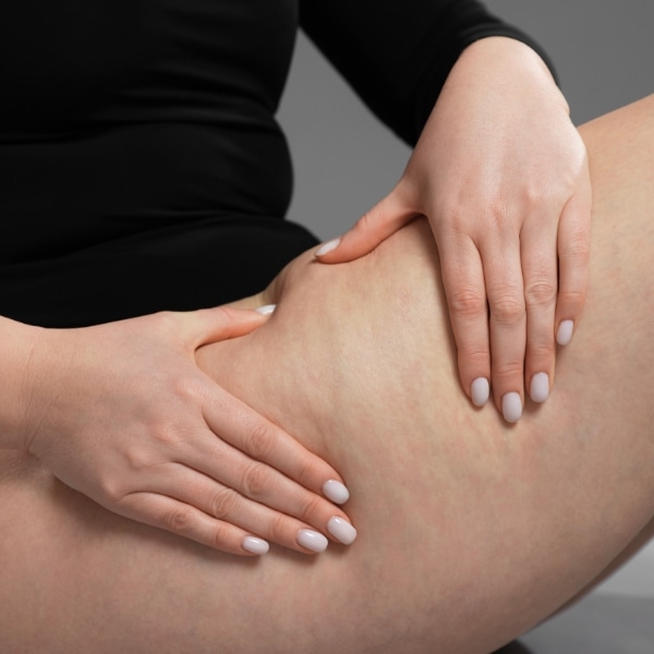 Masaje drenaje linfatico en liposuccion